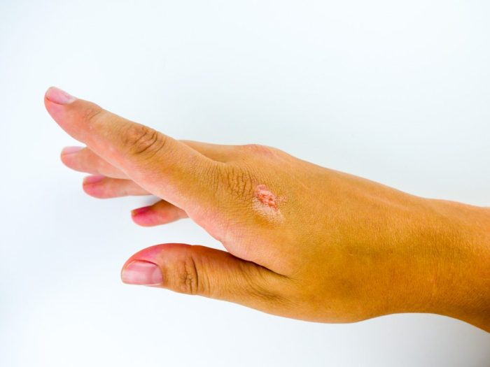Vegan Lip Balm - Image 4